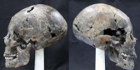 В Южной Корее найден женский череп странной формы