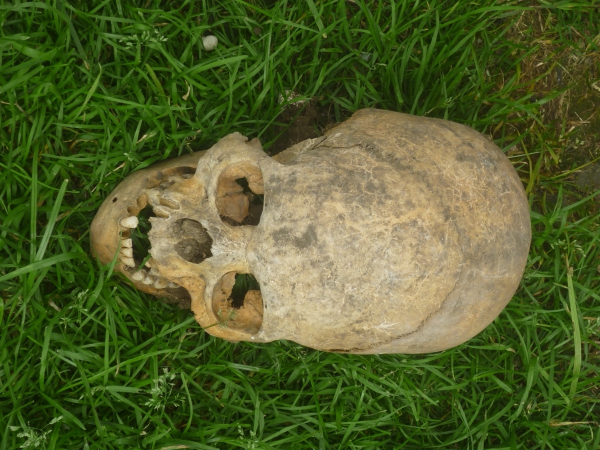 В Кабардино-Балкарии нашли останки людей с вытянутыми черепами